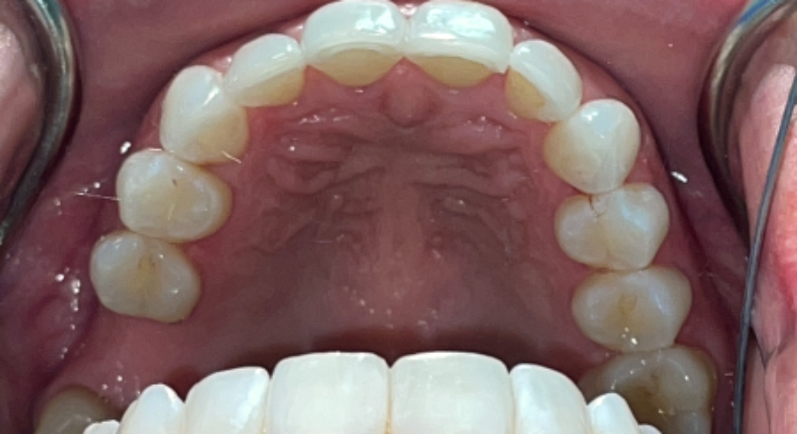 After - Londent Dental