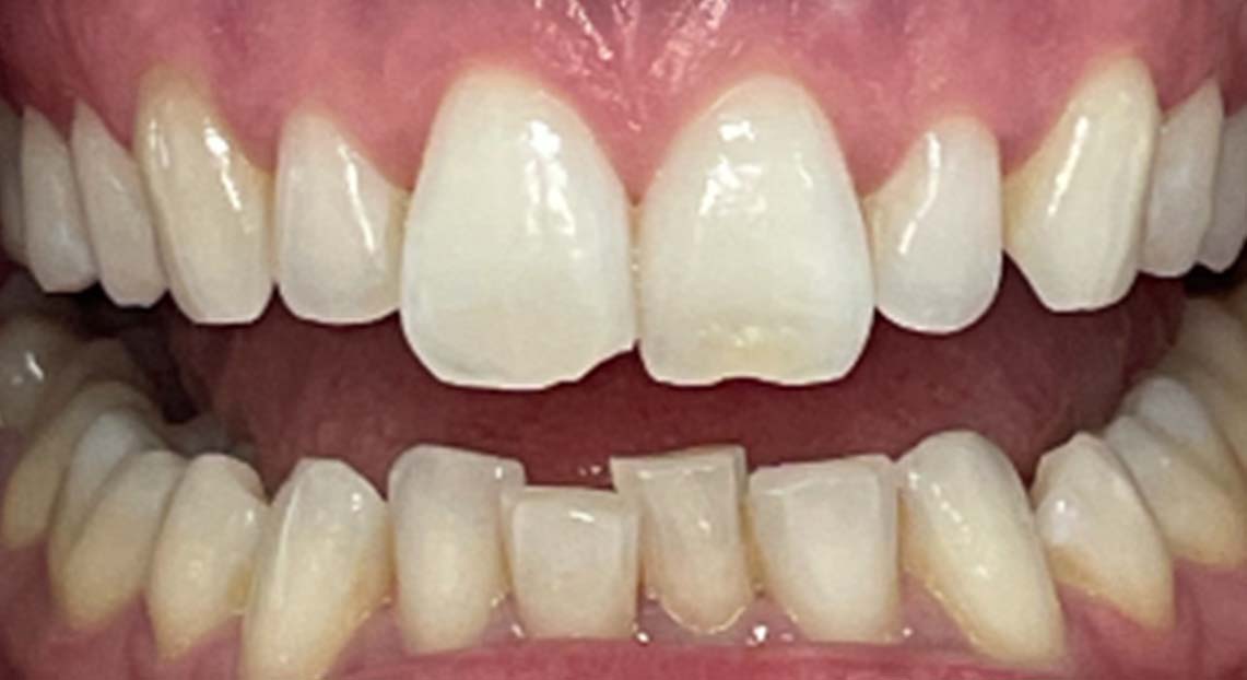 Before - Londent Dental 