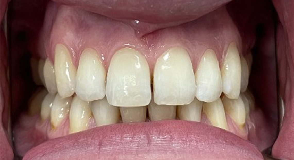 After - Londent Dental