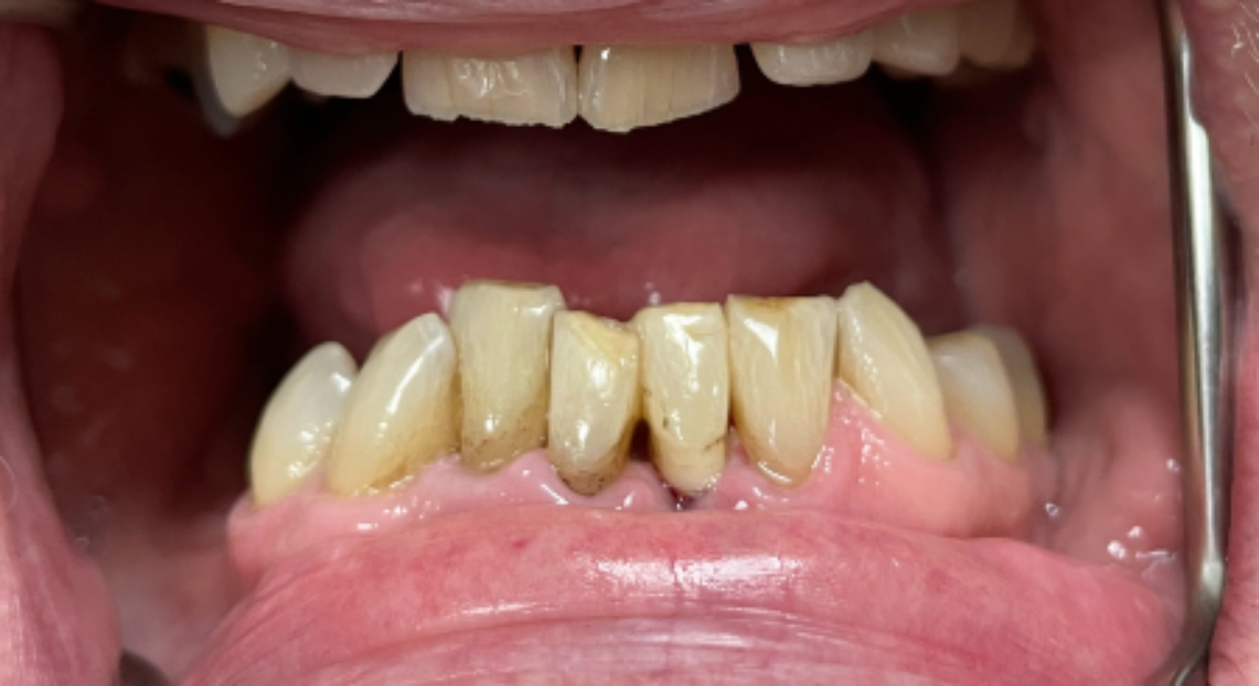 After - Londent Dental 