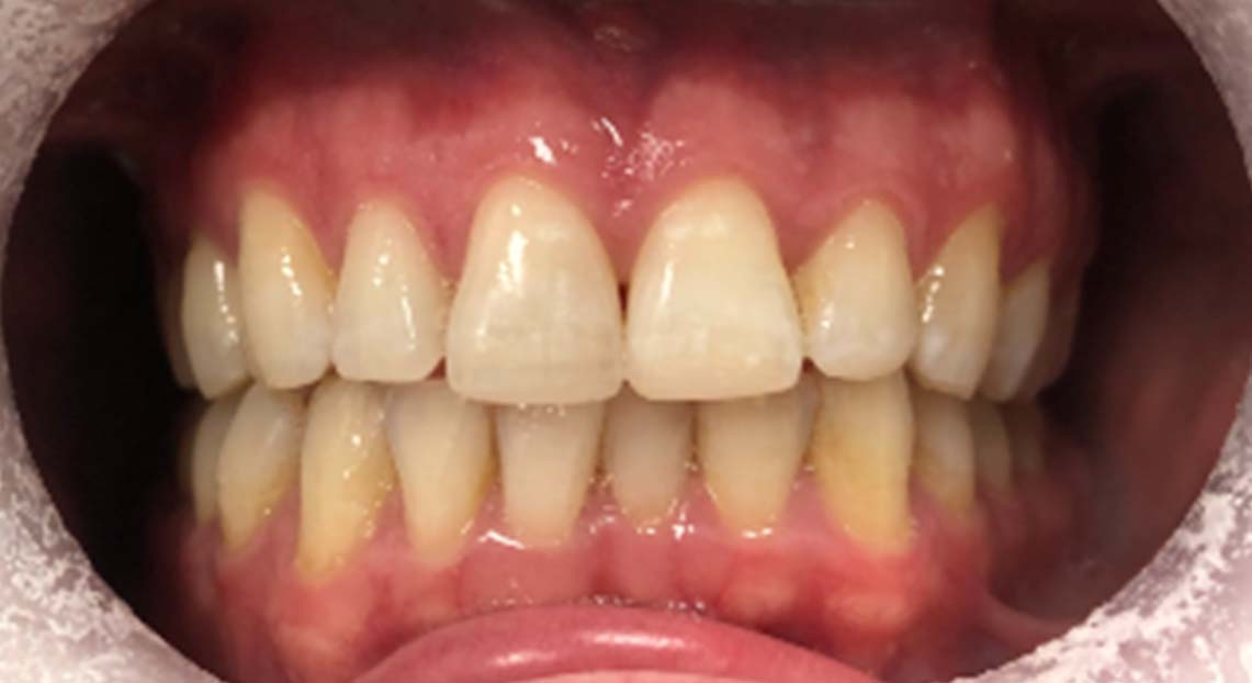 After - Londent Dental