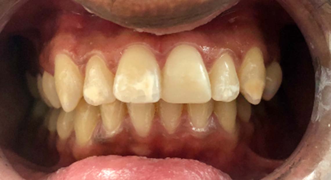 After - Londent Dental 