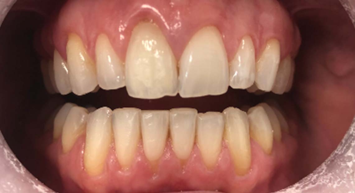 After - Londent Dental