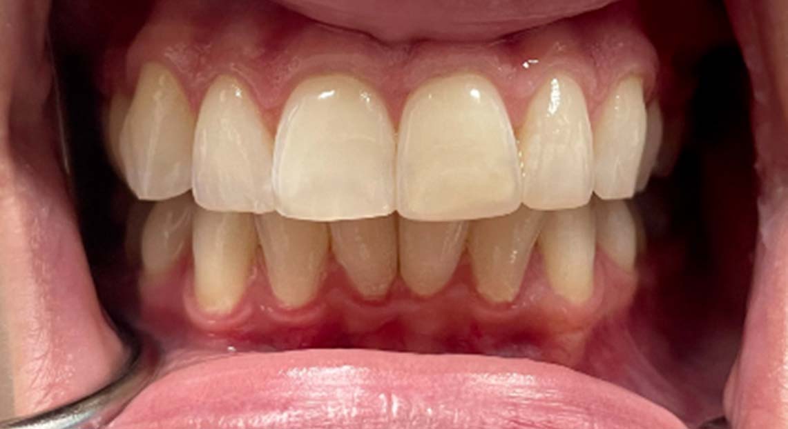 After - Londent Dental