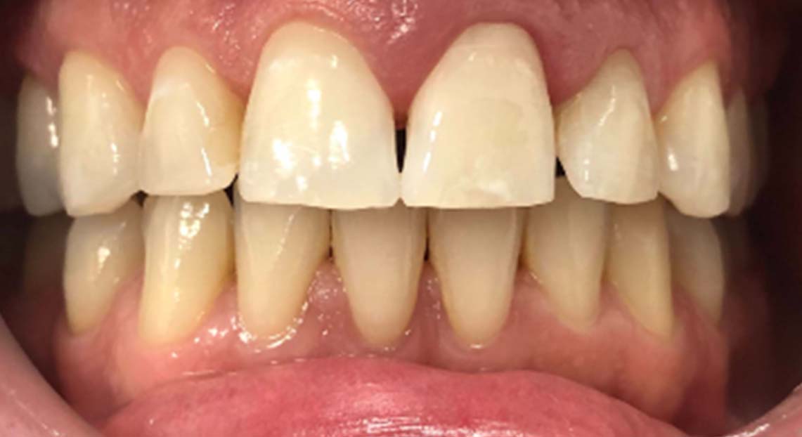 After - Londent Dental 