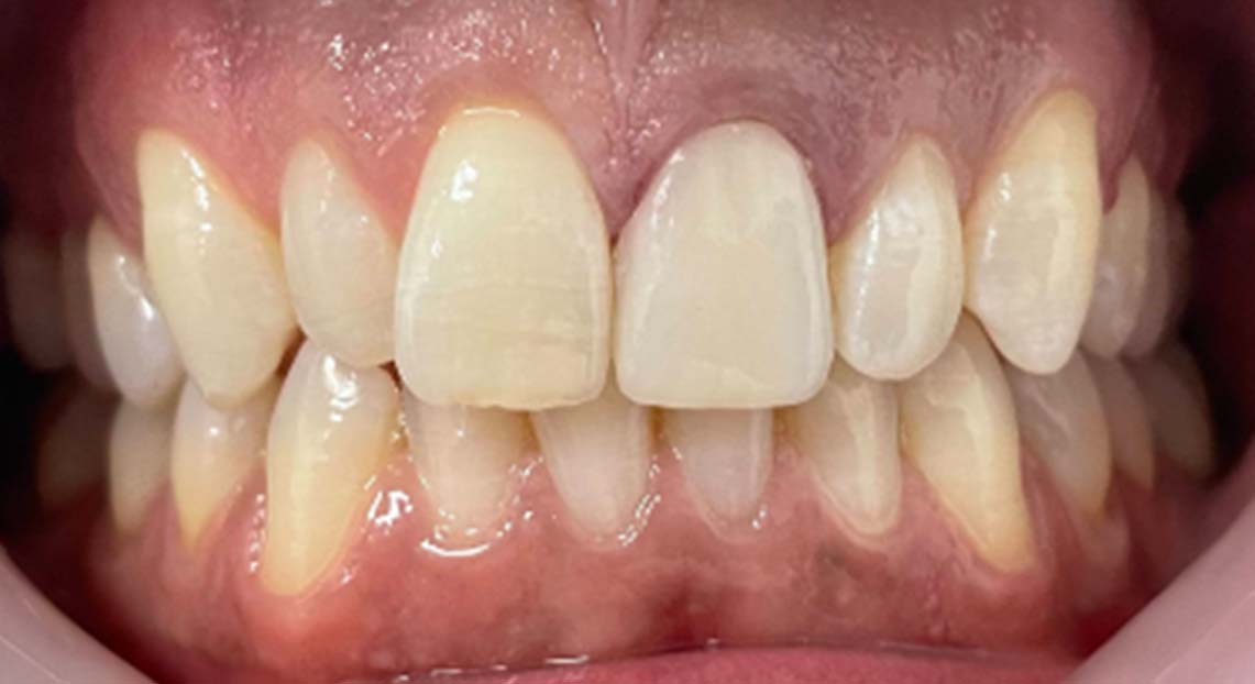 After - Londent Dental 