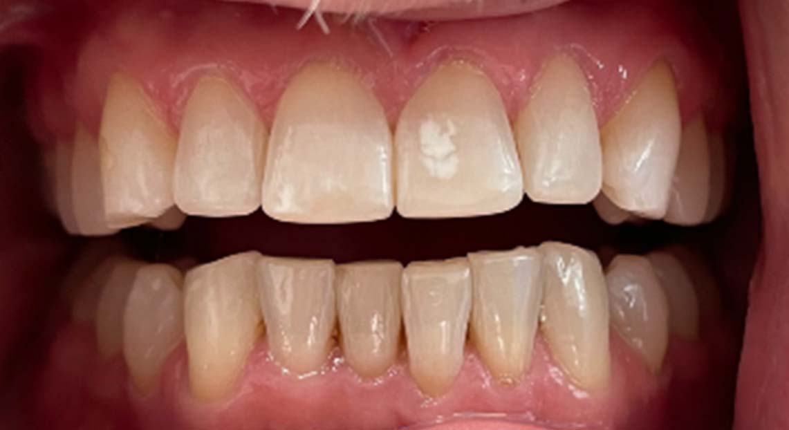 After - Londent Dental