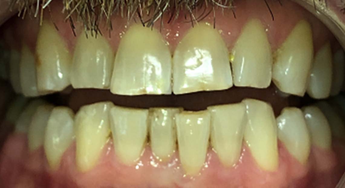 Before - Londent Dental