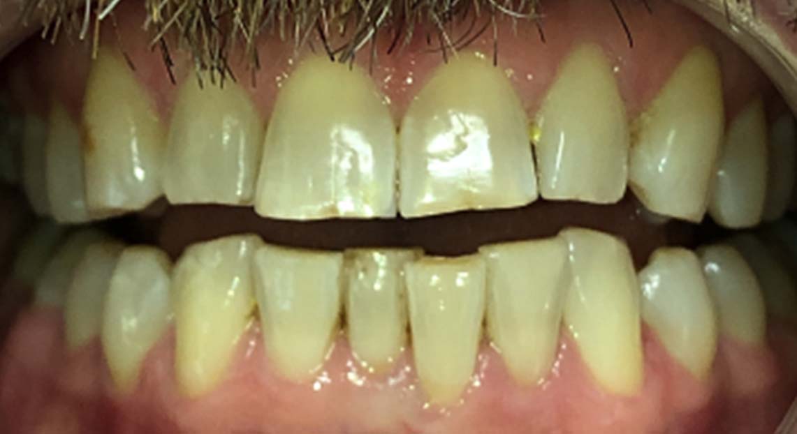 Before - Londent Dental 