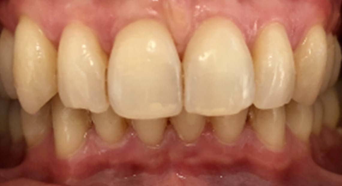 After - Londent Dental 