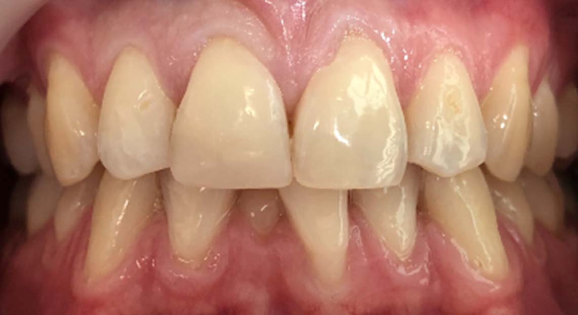 After - Londent Dental