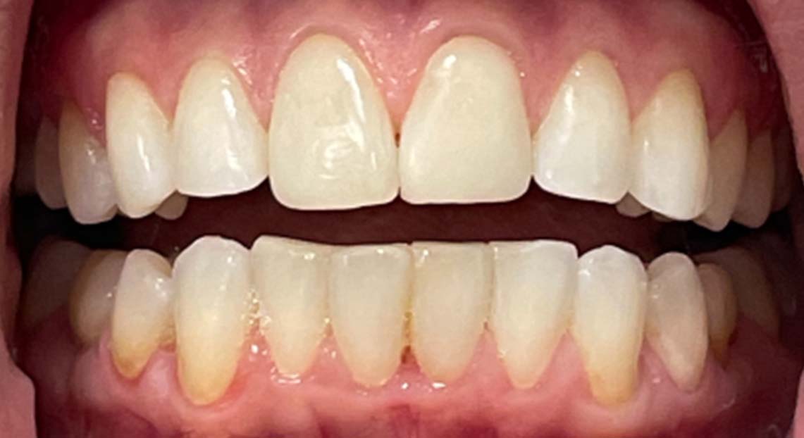 After - Londent Dental