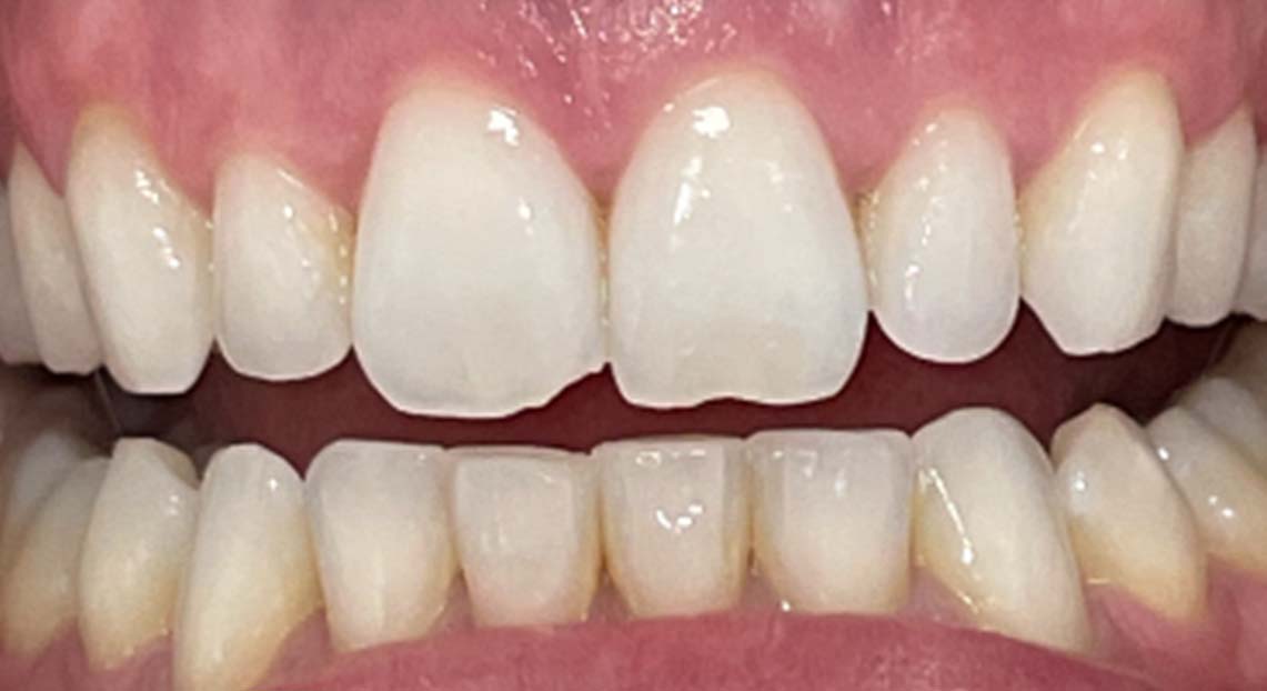 After - Londent Dental