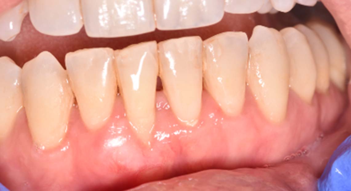 After - Londent Dental