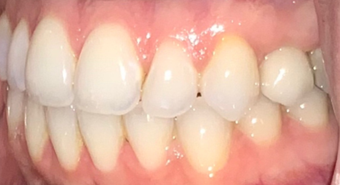 After - Londent Dental