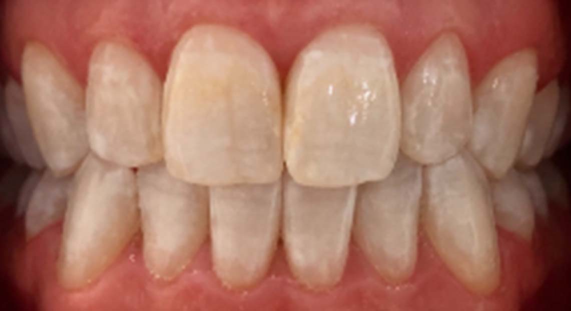 After - Londent Dental 