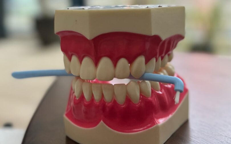 blog - Londent Dental